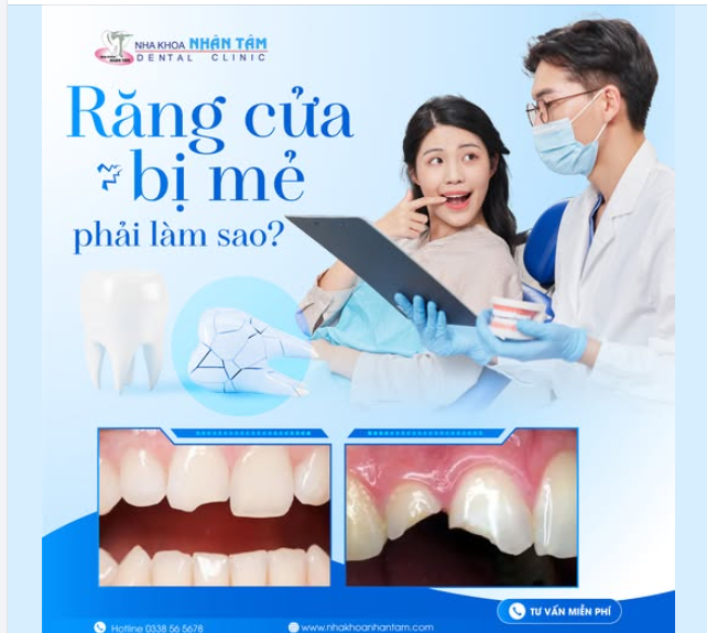 RĂNG CỬA BỊ MẺ PHẢI LÀM SAO?