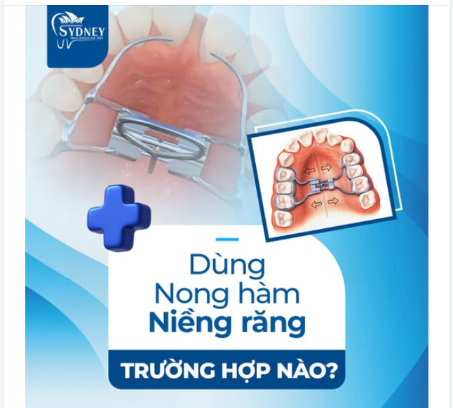 NONG HÀM NIỀNG RĂNG TRONG TRƯỜNG HỢP NÀO?