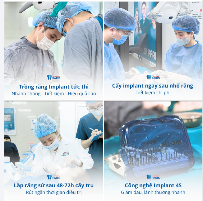 CẤY GHÉP IMPLANT TỨC THÌ - CHỈ 48H PHỤC HỒI RĂNG MẤT