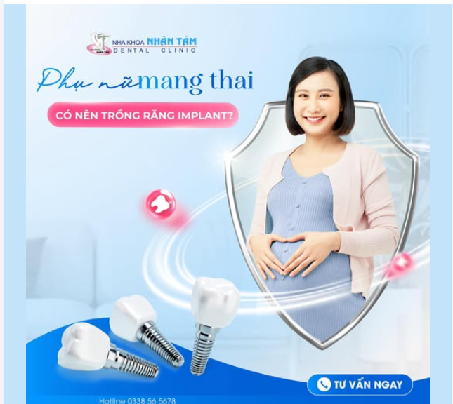 Phụ nữ mang thai trồng răng Implant: Có thật sự an toàn?