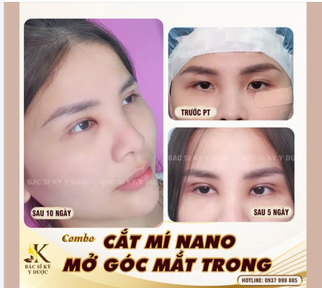 COMBO TỎA SÁNG CỬA SỔ TÂM HỒN