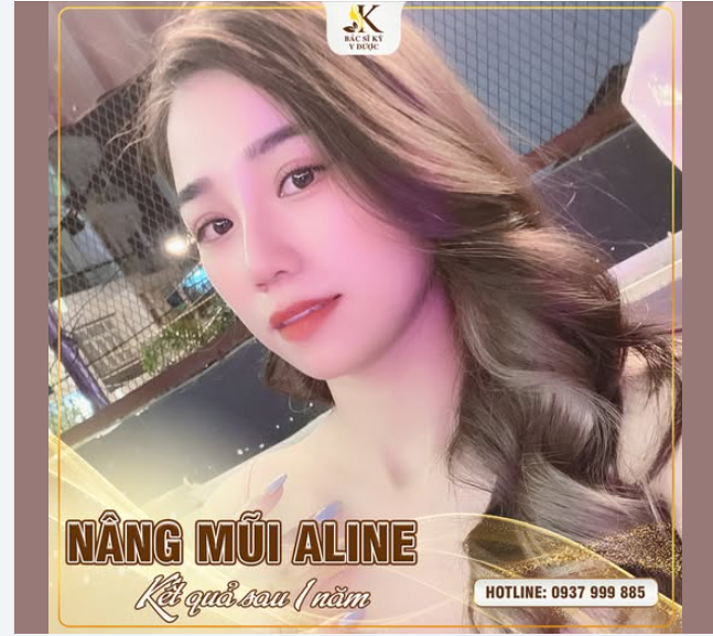 CÁI KẾT ĐẦY "NGỌT NGÀO" SAU 1 NĂM NÂNG MŨI ALINE
