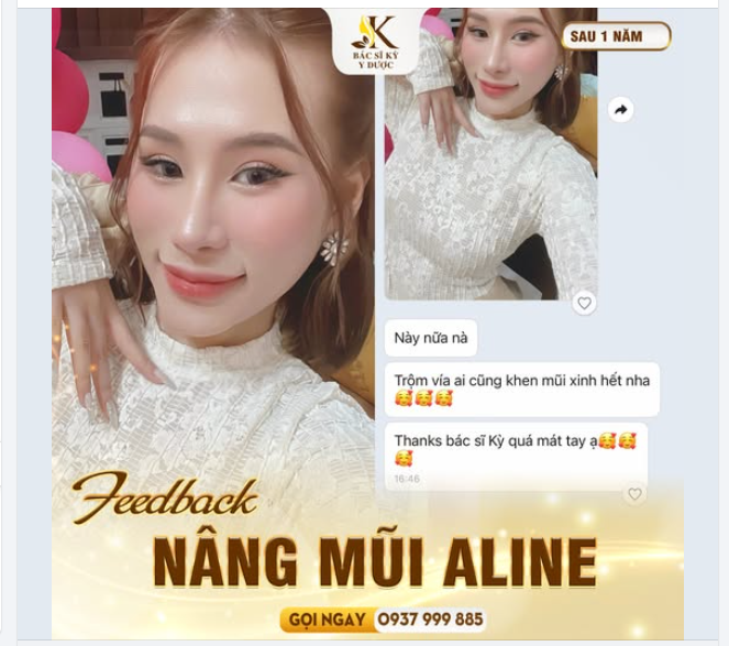 LỘT XÁC HOÀN HẢO VỚI DÁNG MŨI ALINE TẠI BÁC SĨ KỲ Y DƯỢC