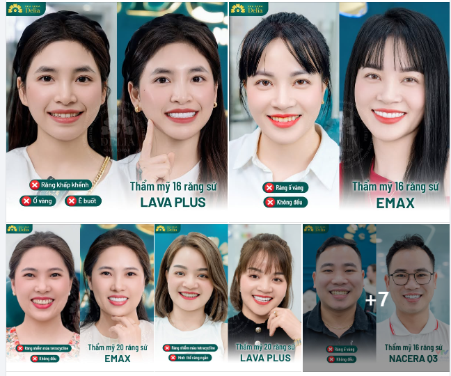 Nha khoa thẩm mỹ quốc tế Delia kiến tạo nụ cười hạnh phúc
