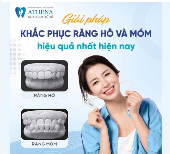 Bạn có biết? Răng hô hay móm không chỉ ảnh hưởng đến thẩm mỹ khuôn mặt mà còn gây khó khăn trong việc ăn nhai và phát âm.