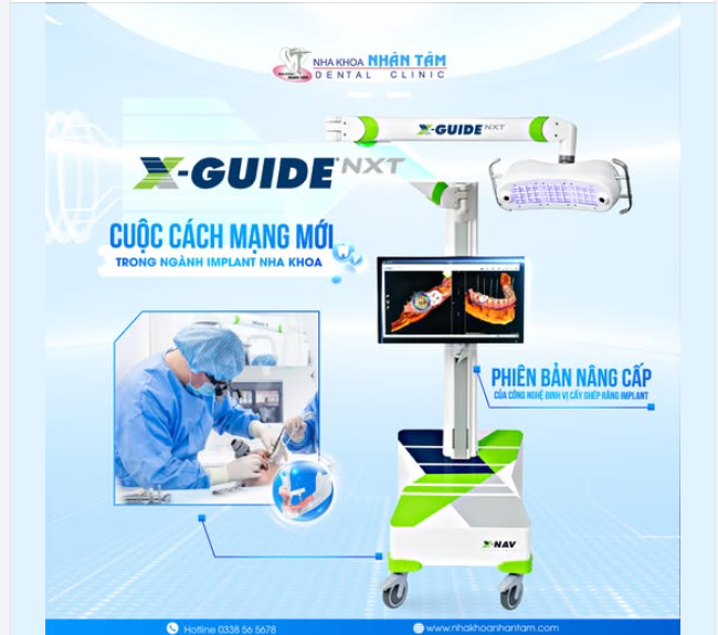 X-Guide NXT - Cuộc cách mạng mới trong ngành Implant nha khoa