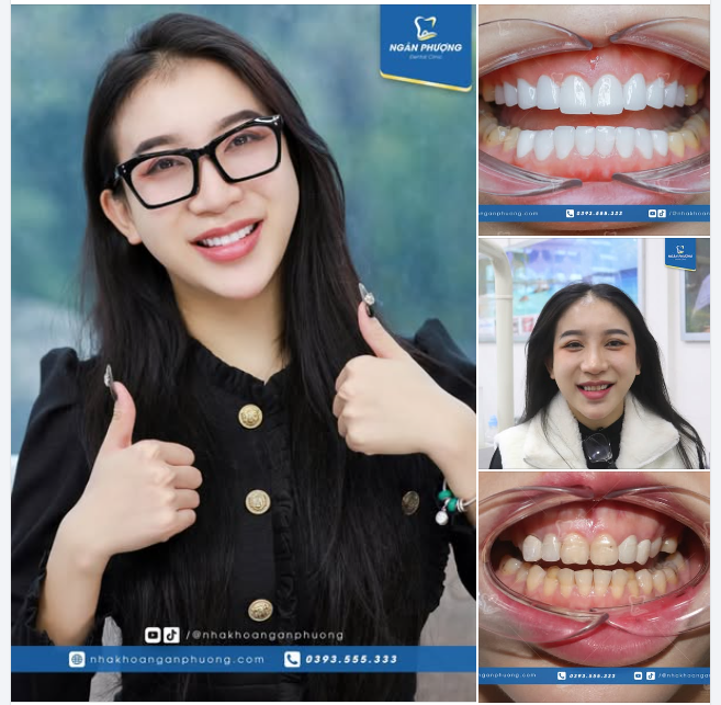 Nụ cười mới của Quỳnh Dương có làm anh chị em xiêu lòng