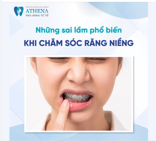 Niềng răng là một hành trình dài đòi hỏi sự kiên nhẫn và chăm sóc đúng cách.