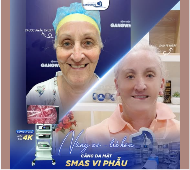 Tại bệnh viện Gangwhoo mỗi ngày chúng tôi đón tiếp rất nhiều khách hàng từ trong nước đến n goài nước để thực hiện những dịch vụ làm đẹp.