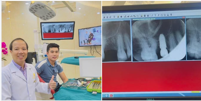 TRỒNG RĂNG IMPLANT ĐÓN TẾT SỚM ĂN NHAI CHẮC CHẮN