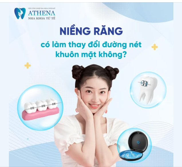 Niềng răng có làm thay đổi đường nét khuôn mặt không?