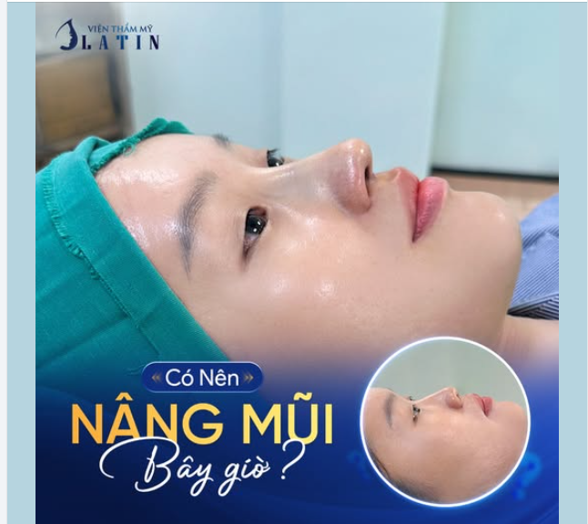CÓ NÊN NÂNG MŨI BÂY GIỜ KHÔNG