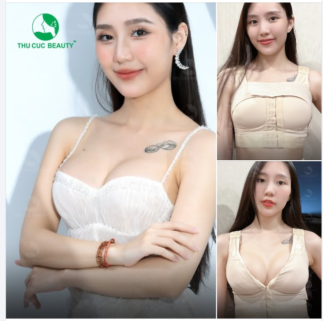 Đến TC để Biến hóa từ teo lép trở nên căng tròn cùng Ngực TC -40%