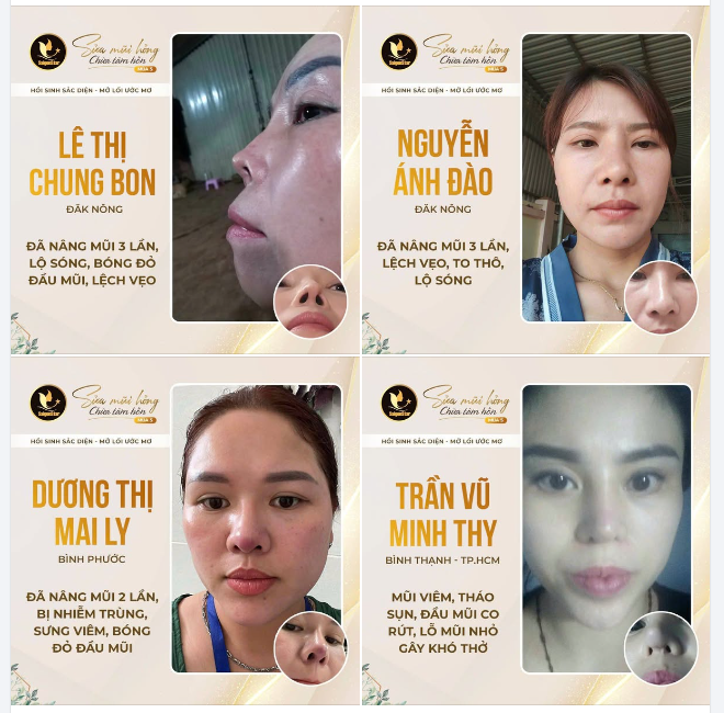 SỬA MŨI HỎNG CHỮA TÂM HỒN MÙA 5  CÙNG BÁC SĨ HOẠT - SỐNG TỰ TIN - TỎA SÁNG HẾT MÌNH