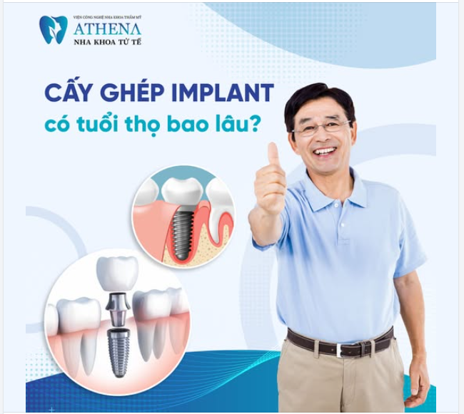 Tuổi thọ của implant bao lâu là được?