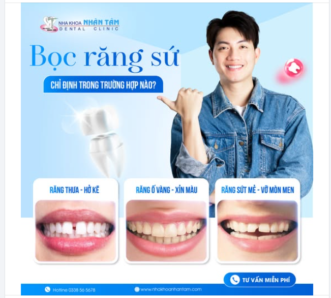BỌC RĂNG SỨ CHỈ ĐỊNH TRONG TRƯỜNG HỢP NÀO?