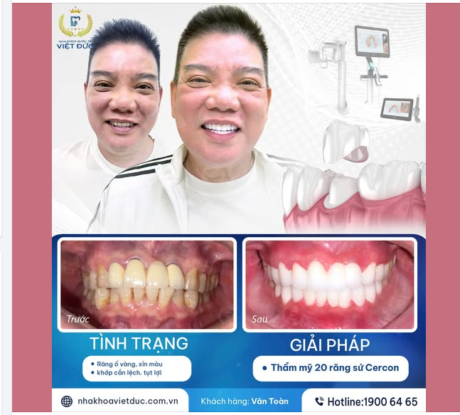NGUYỄN VĂN TOÀN – TỪ "NGẠI CƯỜI" ĐẾN PHONG ĐỘ ĐỈNH CAO