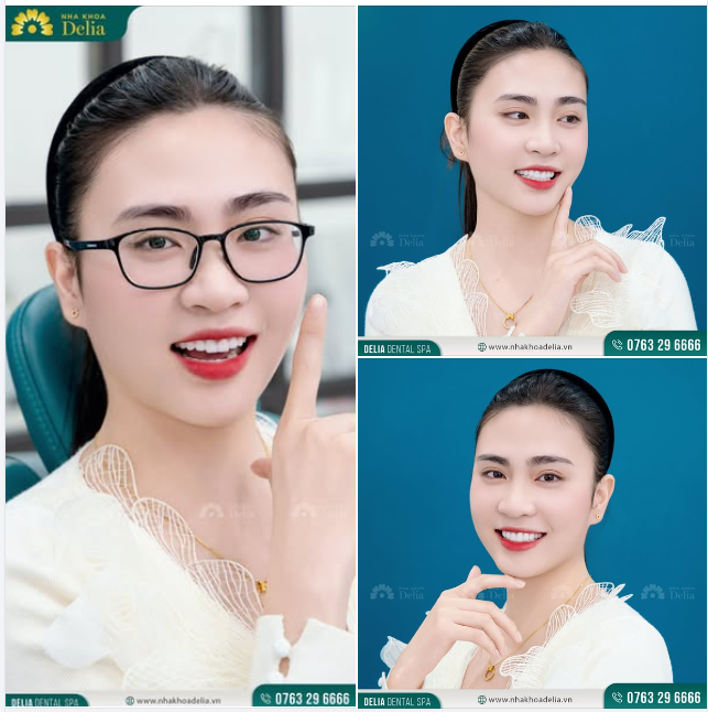 NHA KHOA DELIA KIẾN TẠO NỤ CƯỜI TỎA NẮNG CHO CÔ GIÁO MẦM NON