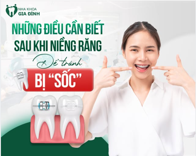 NHỮNG ĐIỀU CẦN BIẾT SAU KHI NIỀNG RĂNG ĐỂ TRÁNH BỊ "SỐC"
