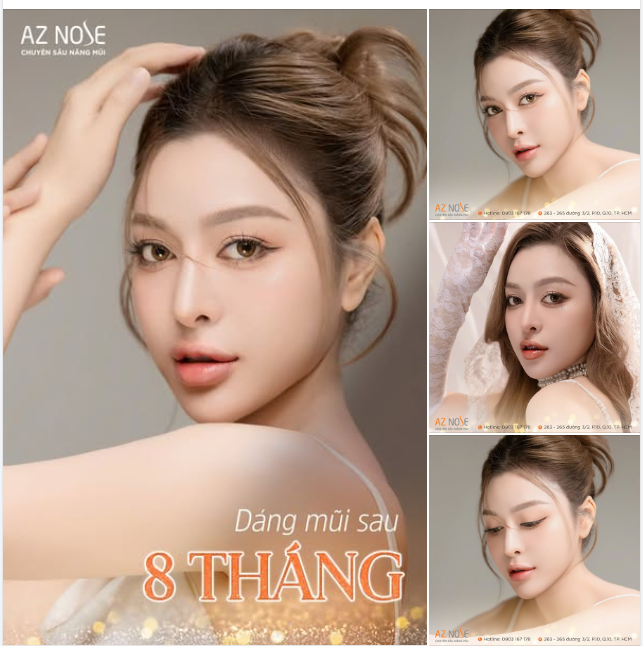 Form mũi cao tây giúp nàng luôn "slay" ở mọi ánh nhìn
