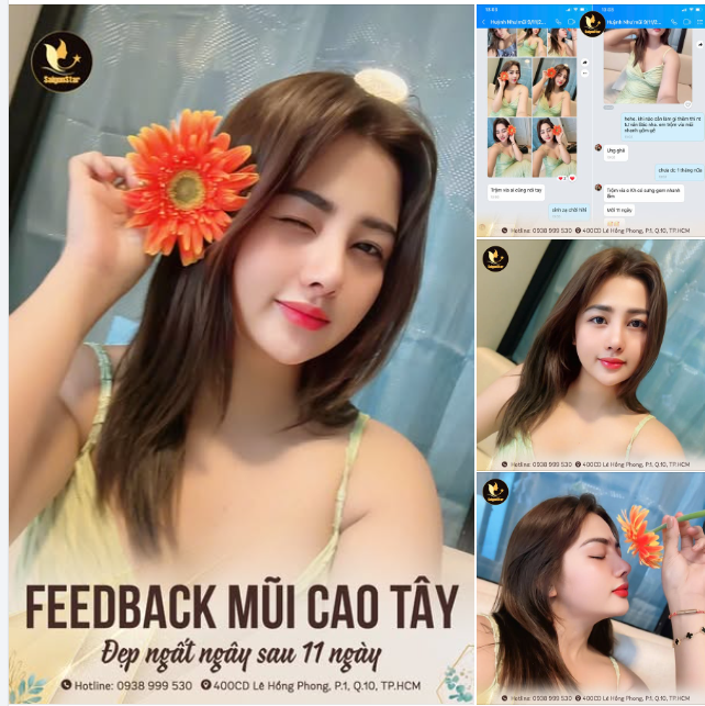 FEEDBACK RẠNG NGỜI SAU 11 NGÀY NÂNG MŨI CẤU TRÚC