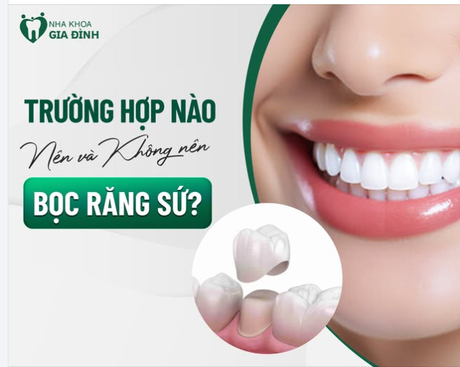 TRƯỜNG HỢP NÀO NÊN VÀ KHÔNG NÊN BỌC RĂNG SỨ MÀ KHÔNG PHẢI NHA KHOA NÀO CŨNG CHO BẠN BIẾT!