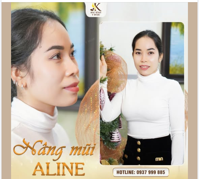 GIÁNG SINH THÊM RỰC RỠ CÙNG DÁNG MŨI ALINE