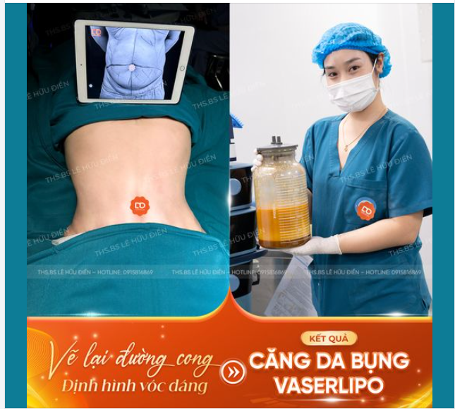 Đường cong cơ thể bị che mất bởi mỡ thừa, da thừa?
