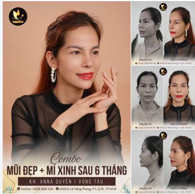 MŨI ĐẸP MÍ XINH - LUNG LINH ĐÓN TẾT