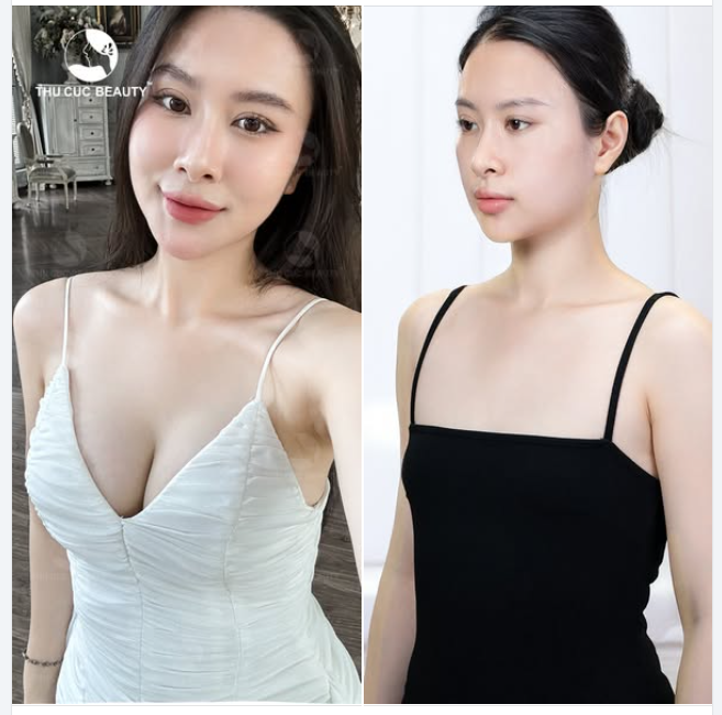 Tạm biệt vòng 1 phẳng lì teo lép