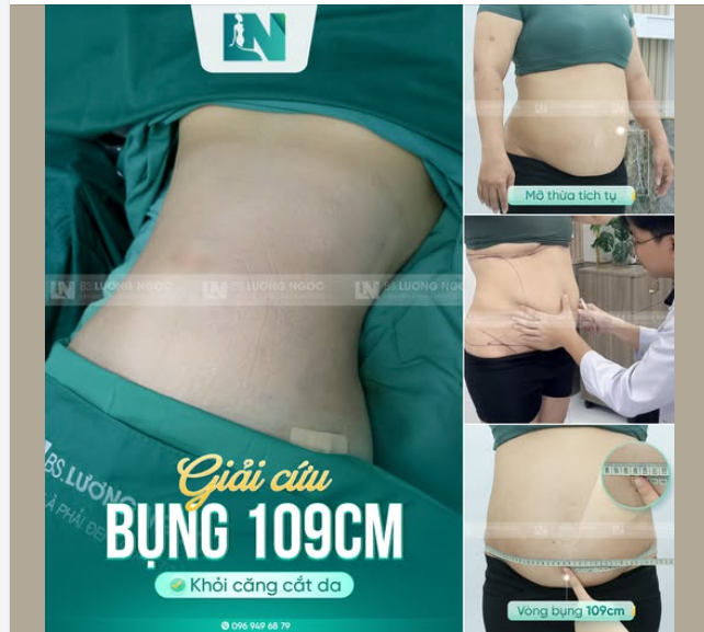 GIẢI CỨU BỤNG KHỔNG LỒ