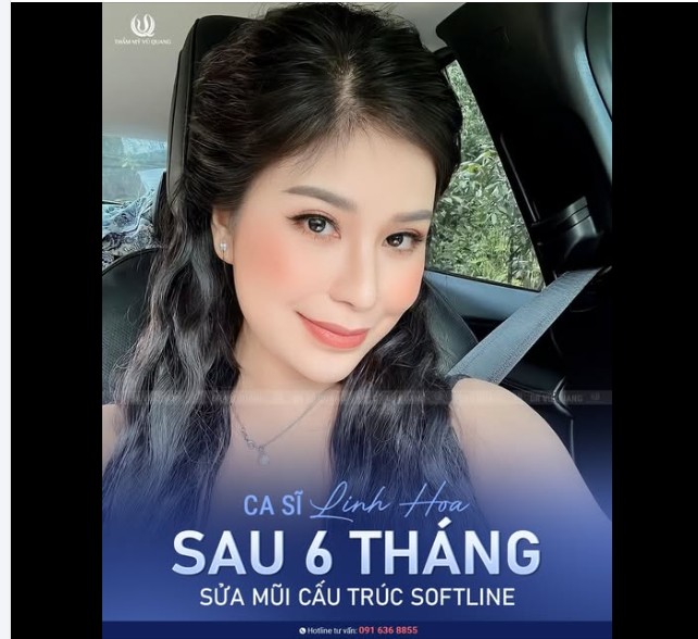 Ca sĩ Linh Hoa quá đỗi xinh đẹp sau 6 tháng sửa lại mũi hỏng do thực hiện tại cơ sở không uy tín, hình ảnh bên ngoài còn xinh hơn ảnh rất nhiều.