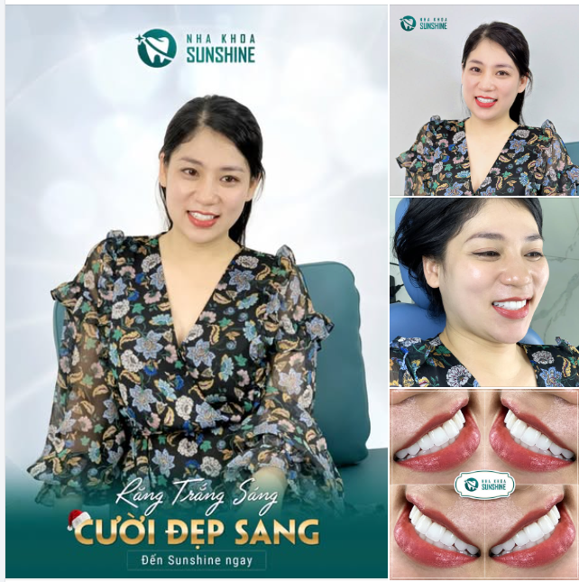 Chị Chu Thanh Hương từng đối diện với nhiều vấn đề răng miệng như răng nhiễm màu, mòn cổ răng, khấp khểnh nhẹ khiến chị tự ti mỗi khi giao tiếp.