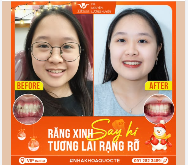 RĂNG XINH “SAY HI”, TƯƠNG LAI RẠNG RỠ