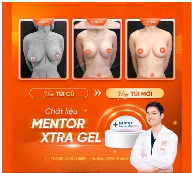 THÁO TÚI CŨ THAY TÚI MỚI
