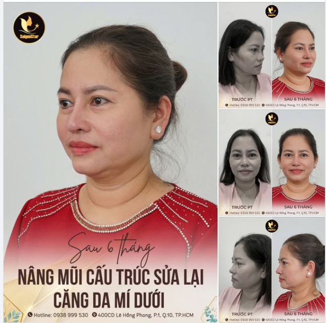 Bật mí cùng cả nhà bí kíp giúp chị Kim Loan trẻ trung tươi tắn ở độ tuổi 50 