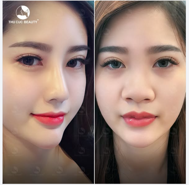 Chiếc mũi thay đổi toàn bộ gương mặt của bạn