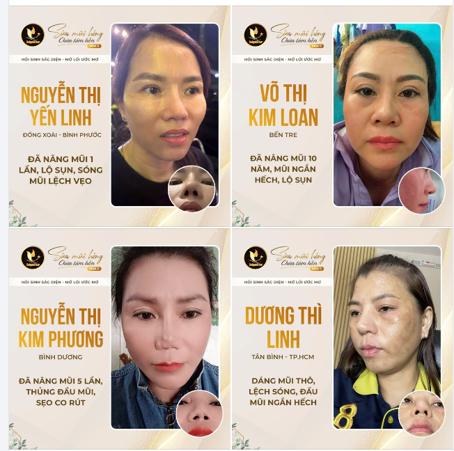 SỬA MŨI HỎNG CHỮA TÂM HỒN MÙA 5  CÙNG BÁC SĨ HOẠT - SỐNG TỰ TIN - TỎA SÁNG HẾT MÌNH