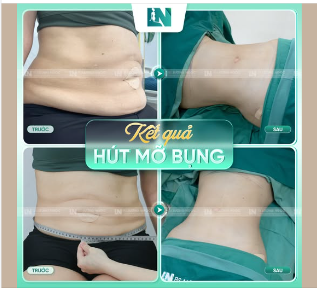Thay đổi cần một quá trình dài nhưng với Ekip Bác sĩ Lương Ngọc chỉ mất hơn 90 phút.
