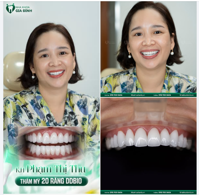 TẨY ƯU PHIỀN - SỐNG TỰ TIN