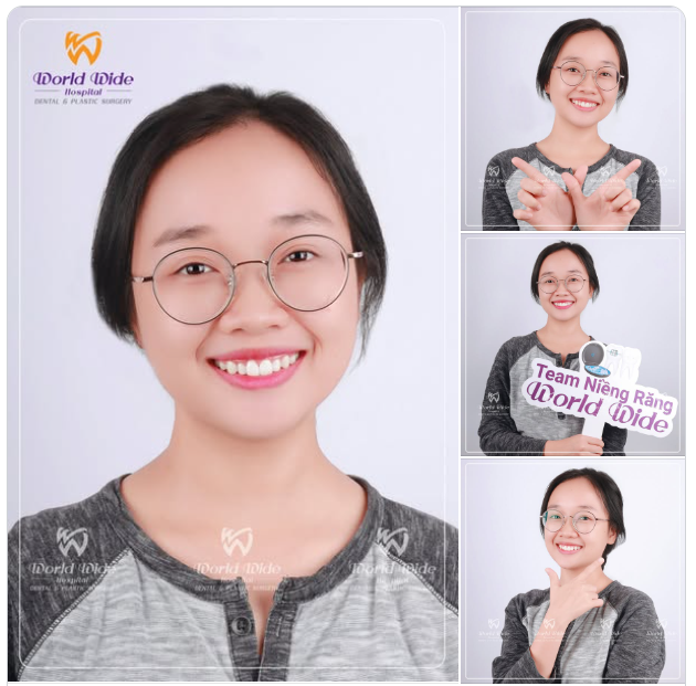“NIỀNG RĂNG XONG, EM CƯỜI NHIỀU HƠN”