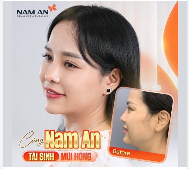 TÁI SINH MŨI HỎNG - LẤY LẠI TỰ TIN CÙNG NAM AN