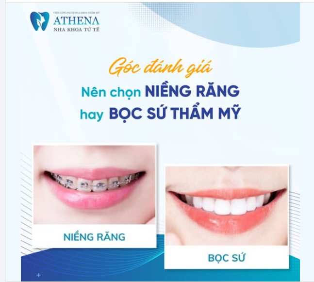 Nên Bọc răng sứ hay niềng răng? Đâu là giải pháp phù hợp cho bạn?
