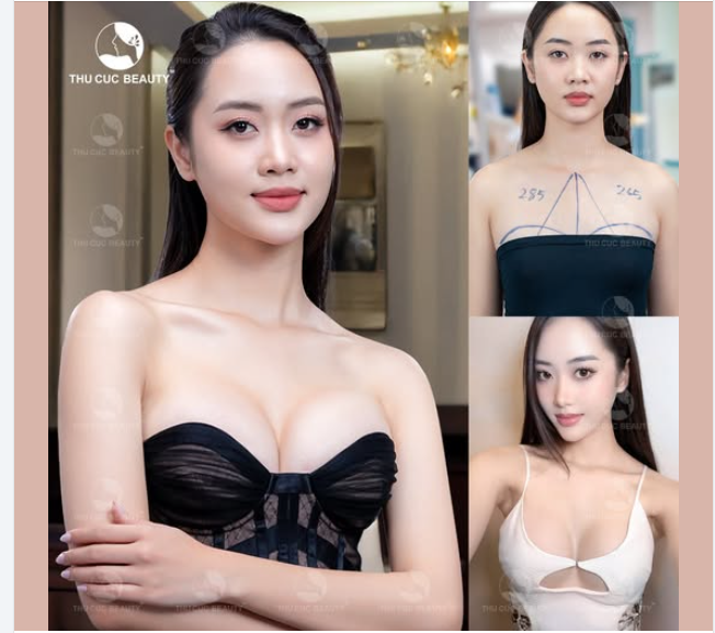 60P tạm biệt teo lép, hai bên xa nhau đến TC Nâng Ngực còn 42.9Tr