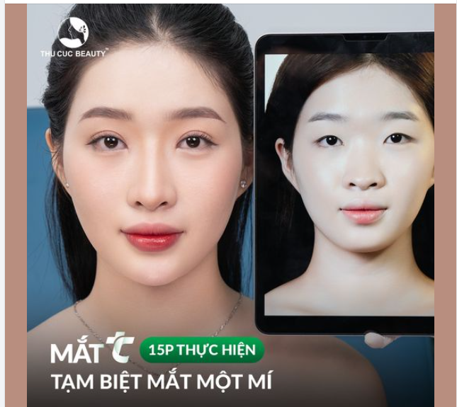 Xem ngay nếp mí KH Vân Anh khác biệt hoàn toàn sau cắt mí tại Thu Cúc