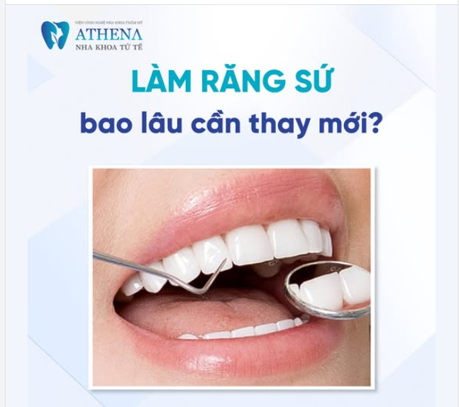 Răng sứ bao lâu thì phải thay mới?