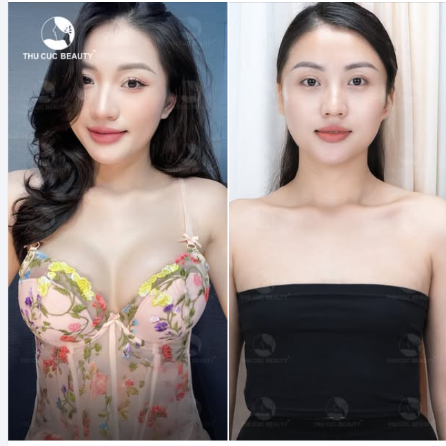 Bạn gặp tình trạng như trên hãy đến TC để được bs tư vấn