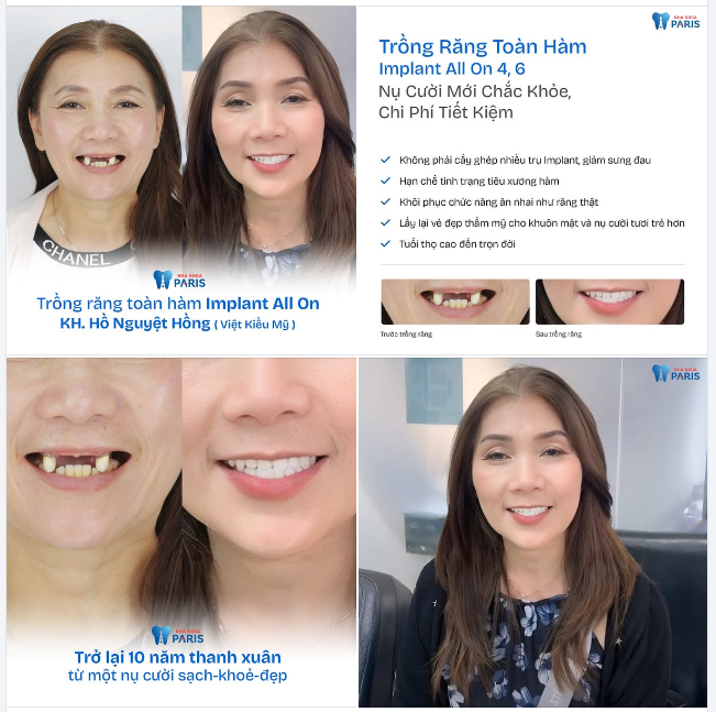 MIỄN CÓ ĐƯỢC NỤ CƯỜI KHOẺ ĐẸP NHƯ Ý, XA ĐẾN MẤY MÌNH CŨNG SẴN SÀNG ĐI