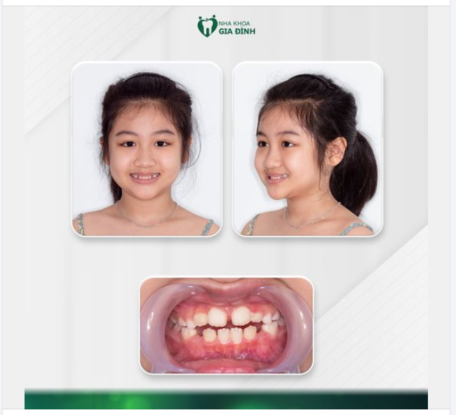 BỐ MẸ HÃY DÀNH TẶNG CON NỤ CƯỜI RẠNG RỠ ĐẾN TRỌN ĐỜI