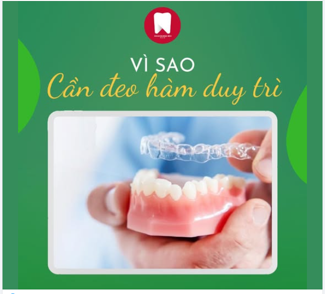 VÌ SAO PHẢI ĐEO HÀM DUY TRÌ SAU NIỀNG RĂNG